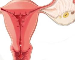 Cómo determinar la ovulación por temperatura basal