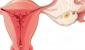 Cómo determinar la ovulación por temperatura basal